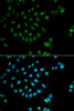 Epigenetics and Nuclear Signaling Antibodies 3 Anti-XRCC2 Antibody CAB1800
