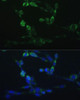 Cell Biology Antibodies 7 Anti-CYP24A1 Antibody CAB1805