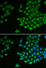 Cell Biology Antibodies 7 Anti-PTPN2 Antibody CAB1808