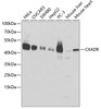Cell Biology Antibodies 7 Anti-CXADR Antibody CAB1822