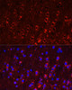 Signal Transduction Antibodies 2 Anti-GRIA1 Antibody CAB1826