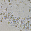 Cell Biology Antibodies 7 Anti-IL-10RA Antibody CAB1830