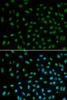 Epigenetics and Nuclear Signaling Antibodies 3 Anti-DDB2 Antibody CAB1848