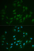 Cell Cycle Antibodies 1 Anti-LIG1 Antibody CAB1858