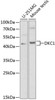 Cell Biology Antibodies 7 Anti-DKC1 Antibody CAB1862