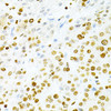 Cell Biology Antibodies 7 Anti-DKC1 Antibody CAB1862