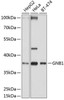 Cell Biology Antibodies 7 Anti-GNB1 Antibody CAB1867
