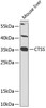 Cell Biology Antibodies 7 Anti-CTSS Antibody CAB1874
