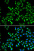 Immunology Antibodies 2 Anti-C1QBP Antibody CAB1883