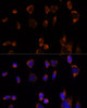 Metabolism Antibodies 2 Anti-PDHA1 Antibody CAB1895