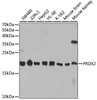KO Validated Antibodies 1 Anti-PRDX2 Antibody CAB1919KO Validated