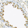 Cell Biology Antibodies 7 Anti-S100A7 Antibody CAB1940