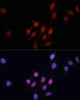 Epigenetics and Nuclear Signaling Antibodies 3 Anti-Smad5 Antibody CAB1947