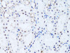 KO Validated Antibodies 1 Anti-Histone H2B Antibody CAB1958KO Validated