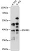 Cell Biology Antibodies 8 Anti-BDKRB1 Antibody CAB1959