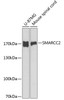 Neuroscience Anti-SMARCC2 Antibody CAB1967