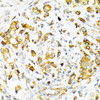 Cell Biology Antibodies 8 Anti-TAPBP Antibody CAB1968