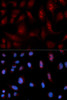 Metabolism Antibodies 2 Anti-PLCB1 Antibody CAB1971