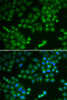 Cell Biology Antibodies 8 Anti-RPL5 Antibody CAB1977