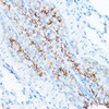 Cell Biology Antibodies 8 Anti-TMPRSS2 Antibody CAB1979