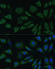 Cell Biology Antibodies 8 Anti-BMPR1B Antibody CAB2005