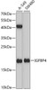 Cell Biology Antibodies 8 Anti-IGFBP4 Antibody CAB2008