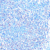 Epigenetics and Nuclear Signaling Antibodies 3 Anti-SNRPB Antibody CAB2009