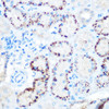 Cardiovascular Antibodies Anti-ANGPTL4 Antibody CAB2011