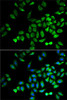 Cardiovascular Antibodies Anti-ANGPTL4 Antibody CAB2011
