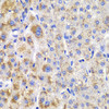 Signal Transduction Antibodies 2 Anti-CBLB Antibody CAB2014