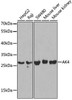 Cell Biology Antibodies 8 Anti-AK4 Antibody CAB2050