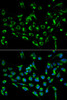 Cell Cycle Antibodies 1 Anti-CDKN3 Antibody CAB2061