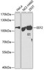 Metabolism Antibodies 2 Anti-EEF2 Antibody CAB2068