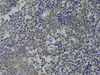 Cell Biology Antibodies 8 Anti-GNA15 Antibody CAB2080