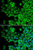 Cell Biology Antibodies 8 Anti-HCK Antibody CAB2083