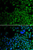 Cell Biology Antibodies 8 Anti-HDAC2 Antibody CAB2084