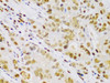 Immunology Antibodies 2 Anti-IKKBeta Antibody CAB2087