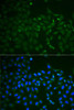 Cell Death Antibodies 1 Anti-TNFRSF11B Antibody CAB2100