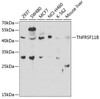 Cell Death Antibodies 1 Anti-TNFRSF11B Antibody CAB2100