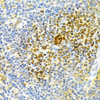 Cell Death Antibodies 1 Anti-TNFRSF11B Antibody CAB2100