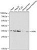 Cell Biology Antibodies 8 Anti-PPA1 Antibody CAB2108