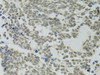 Cell Biology Antibodies 8 Anti-PPP4C Antibody CAB2109