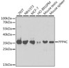 Cell Biology Antibodies 8 Anti-PPP4C Antibody CAB2109