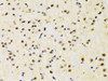 Cell Death Antibodies 1 Anti-PTEN Antibody CAB2113