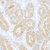 Cell Biology Antibodies 8 Anti-SORD Antibody CAB2118
