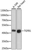 Cell Biology Antibodies 8 Anti-TGFB1 Antibody CAB2124