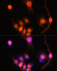 Signal Transduction Antibodies 2 Anti-UCHL1 Antibody CAB2131