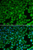 Cell Biology Antibodies 8 Anti-NDRG1 Antibody CAB2142