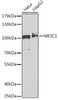 Cell Death Antibodies 1 Anti-NR3C1 Antibody CAB2164