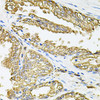 Immunology Antibodies 2 Anti-HLA-DQA1 Antibody CAB2168
